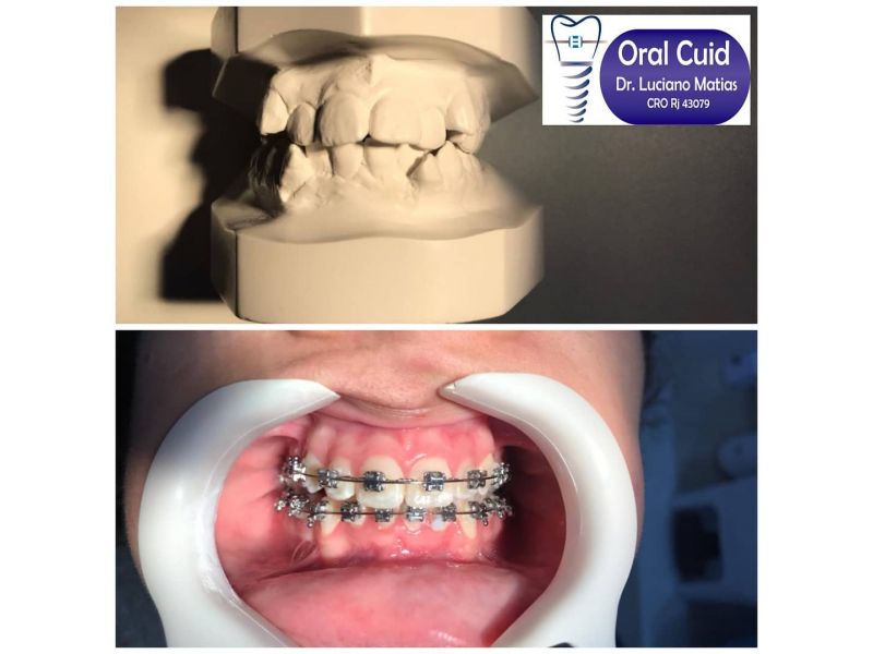 Oral Cuid - Dr. Luciano Matias - (em frente da Clinica da Família)